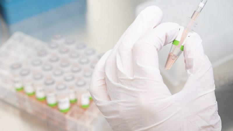 Eine biologisch-technische Assistentin bereitet im PCR-Labor vom Niedersächsischen Landesgesundheitsamt (NLGA) Corona-Tests für die Analyse vor.