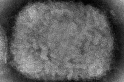Affenpocken: Aidshilfe sieht keinen Grund zur Panik