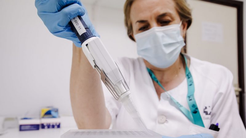 Eine Krankenschwester bereitet im Krankenhaus Ramon y Cajal in Madrid einen PCR-Tests zur Erkennung des Affenpockenvirus vor.