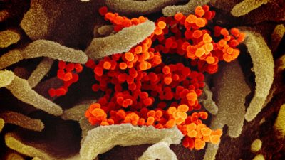 WHO fordert Prüfung von Laborthese zum Virus-Ursprung