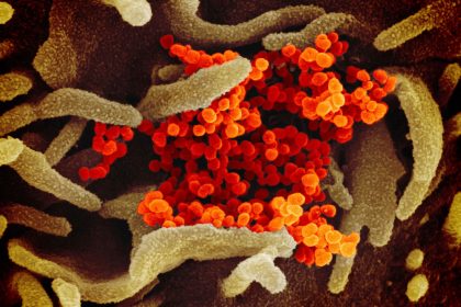 WHO fordert Prüfung von Laborthese zum Virus-Ursprung