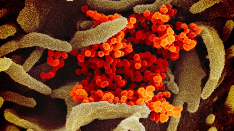 Das Coronavirus (SARS-CoV-2) (orange), das aus der Oberfläche von im Labor kultivierten Zellen (grau) austritt. Die Probe wurde von einem Patienten in den USA isoliert.