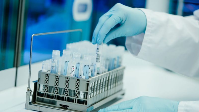 Ein Mitarbeiter hält in einem Labor PCR-Teströhrchen in den Händen.