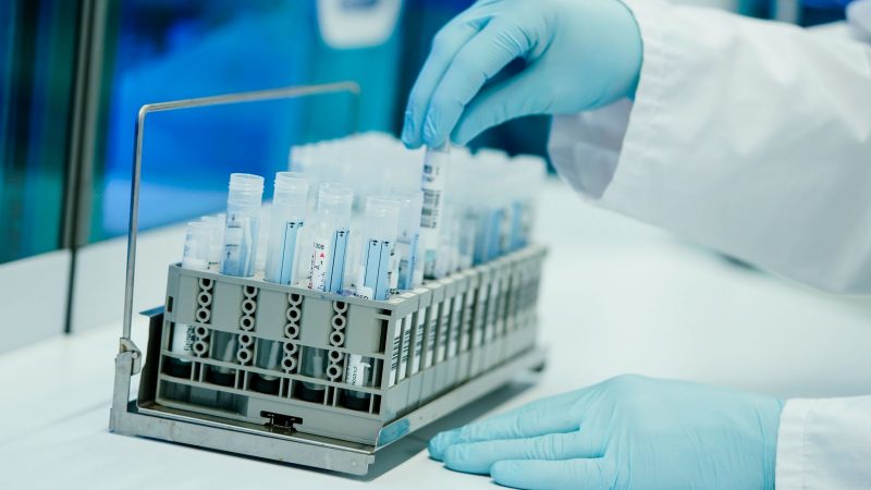 Die Mitarbeiter eines Heidelberger PCR-Testlabors bereitet PCR-Teströhrchen vor.