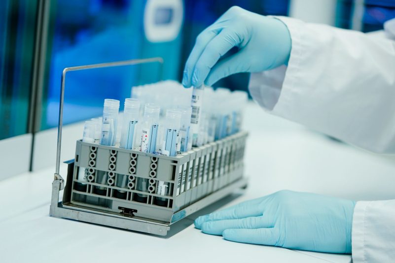 Die Mitarbeiter eines Heidelberger PCR-Testlabors bereitet PCR-Teströhrchen vor.