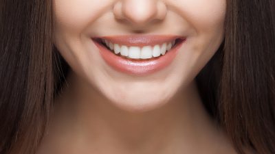 Zähnebleichen: Das Für und Wider weißerer Zähne