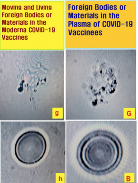 Fremdkörper im COVID-19-Impfstoff