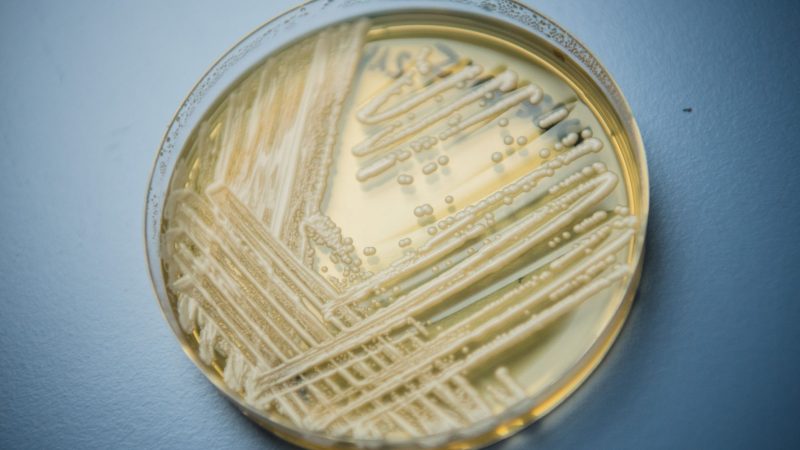 Der Hefepilz Candida auris in einer Petrischale. Die Weltgesundheitsorganisation (WHO) ist besorgt über 19 kranheitserregende Pilze, die nach Expertenansicht die öffentliche Gesundheit bedrohen.