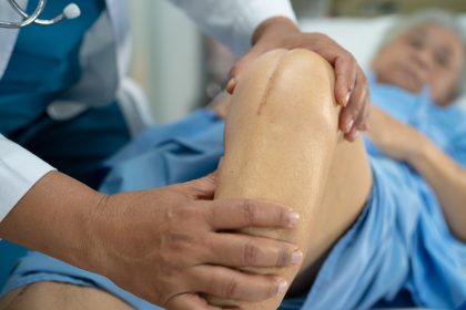 Therapie nicht ausgereizt – jeder zehnte Knieersatz ist vermeidbar