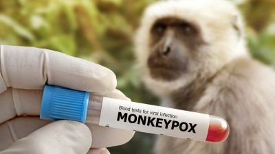 Affenpocken: WHO erwartet in drei Jahren gefährliche Virusvariante