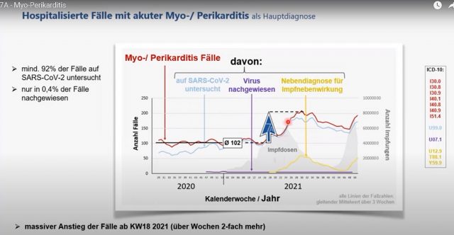 InEK-Daten zeigen: Myokarditis-Anstieg seit KW 18/2021