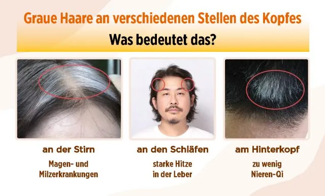 Graue Haare an verschiedenen Stellen des Kopfes