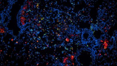 Lungenschnitt einer mit Tuberkulose (Schwindsucht) infizierten Maus unter dem Mikroskop mit Wirkstoff-Nanopartikeln (rot), Kernen der Lungenzellen (blau) und gekaperten Immunzellen (grün). Foto: Forschungszentrum Borstel, Zelluläre Mikrobiologie, Dr. N. Redinger.