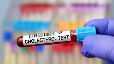 Cholesterin: Gesundheitsrisiko oder medizinische Fehlinterpretation?