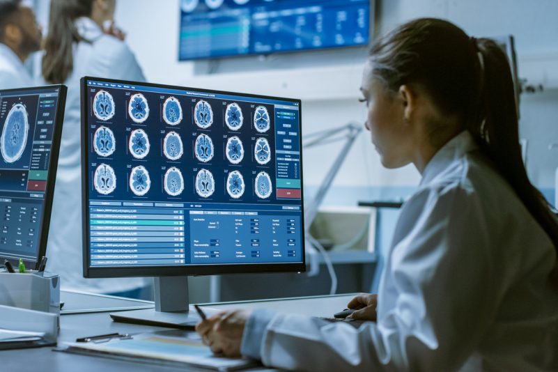 Pilzinfektion im Gehirn – Studie zeigt Parallelen zu Alzheimer