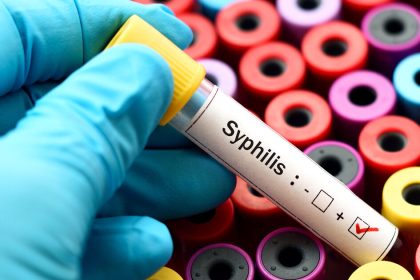 Die Syphilis-Zahlen steigen