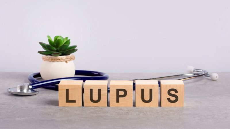 Möglicher Faktor für Lupus bei Kindern entdeckt