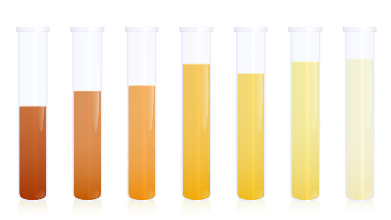 Farben des Urins und ihre gesundheitliche Bedeutung