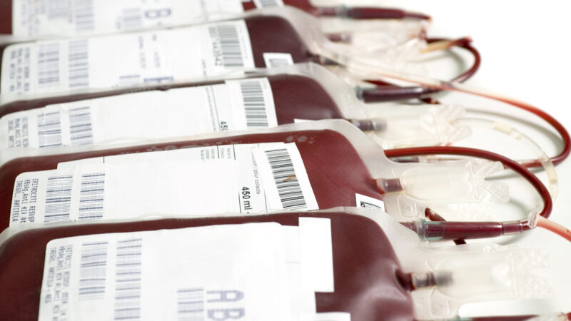 Japanische Forscher: Bedenken bei Bluttransfusionen von COVID-19-Geimpften