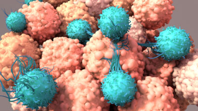 Neue Studie: Spike-Protein könnte Krebszellwachstum unterstützen
