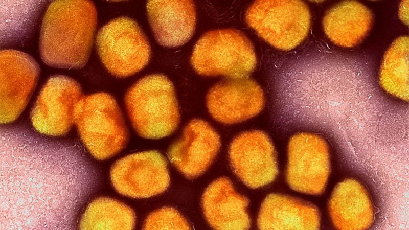 Eine neue Variante des Mpox-Virus könnte gefährlicher sein als bisherige Varianten.