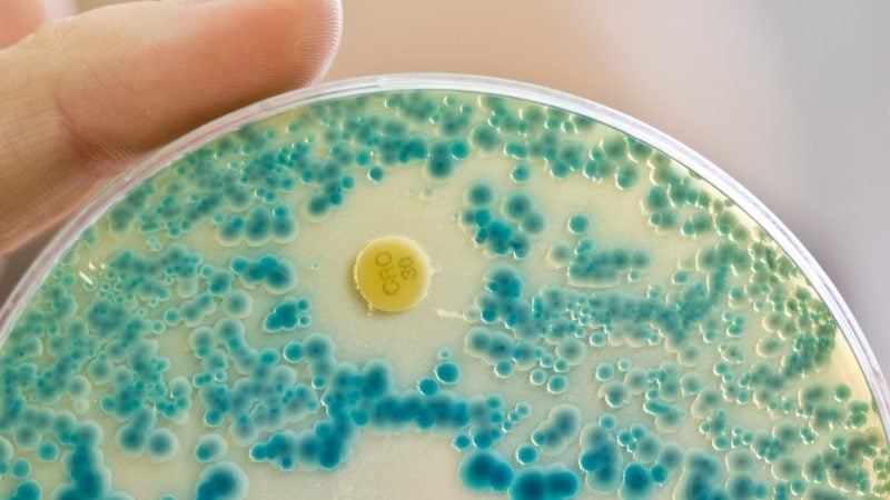 Resistenz gegen Antibiotika: Studie fordert neue Strategien durch optimierte Anwendung