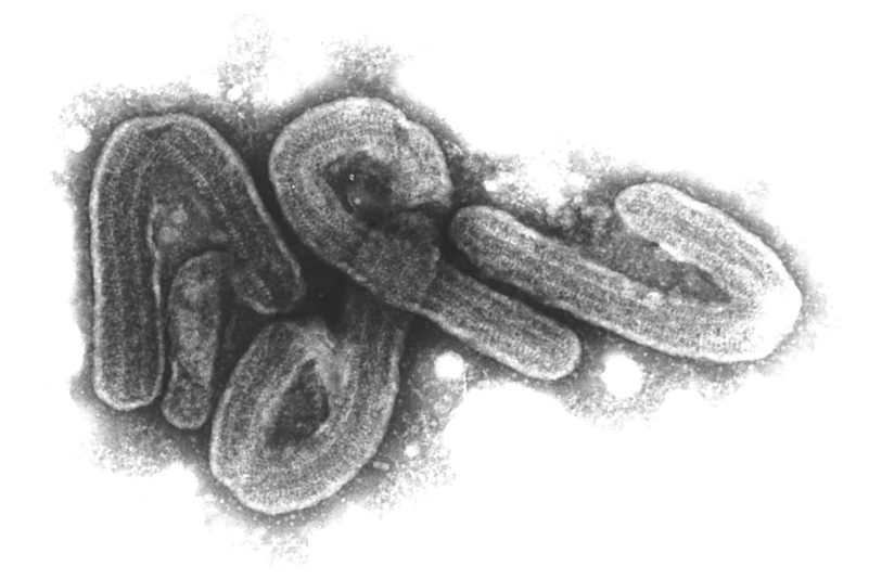 Elektronenmikroskopische Aufnahme des Marburg-Virus. Das Marburg-Virus gehört zu den gefährlichsten bekannten Krankheitserregern.
