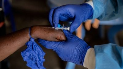 Mpox: Erster Fall neuer Klade Ib-Variante in Deutschland bestätigt