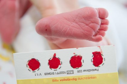 Ein Tropfen Blut: Babyscreening auf Krankheiten – Genomische Sequenzierung geplant