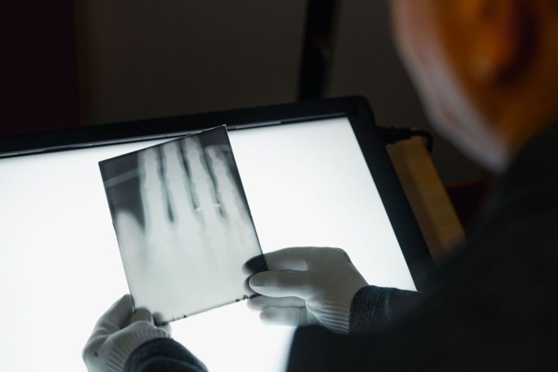 Ein Röntgenbild der Hand von Wilhelm Röntgen gehört nun zum Unesco-Weltdokumentenerbe. (Archivbild)