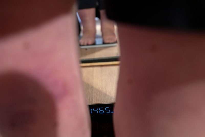 Bei einer Aktion des türkischen Gesundheitsministeriums werden Menschen an öffentlichen Plätzen gewogen. (Archivbild)