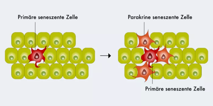 Zombie-Zellen stressen ihre Nachbarn.