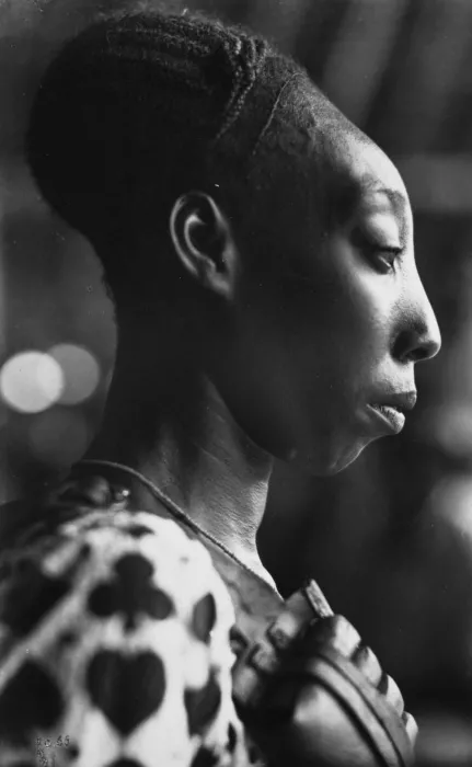 Afrikanische Frau mit Turmschädel