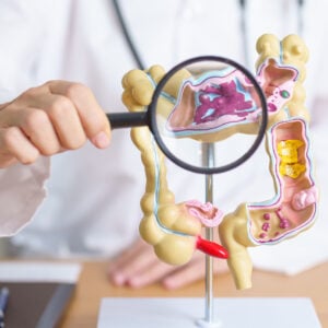 Darmspiegelung: Große Studie zeigt überraschende Ergebnisse – lohnt sich die Untersuchung?