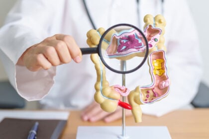 Darmspiegelung: Große Studie zeigt überraschende Ergebnisse – lohnt sich die Untersuchung?