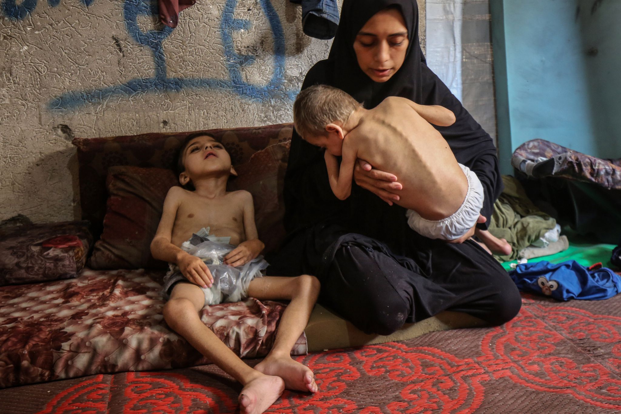 Kinderbilder-aus-Gaza-in-der-Kritik-Vorerkrankungen-verschwiegen