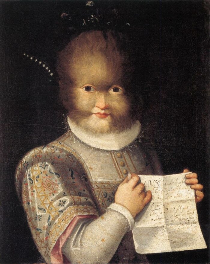 Tochter des Biest: Tognina Gonsalvus