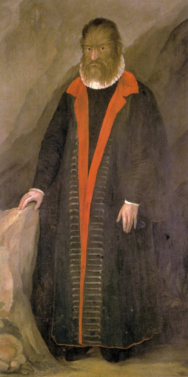 Das „Biest“: Pedro Gonsalvus