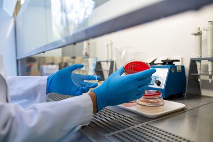 Ehec-Erkrankungen: Mögliche Verbindung zu Wurst-Rückrufaktion wird geprüft