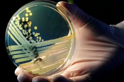 Ehec-Fälle in Vorpommern und Belgien hängen nicht zusammen